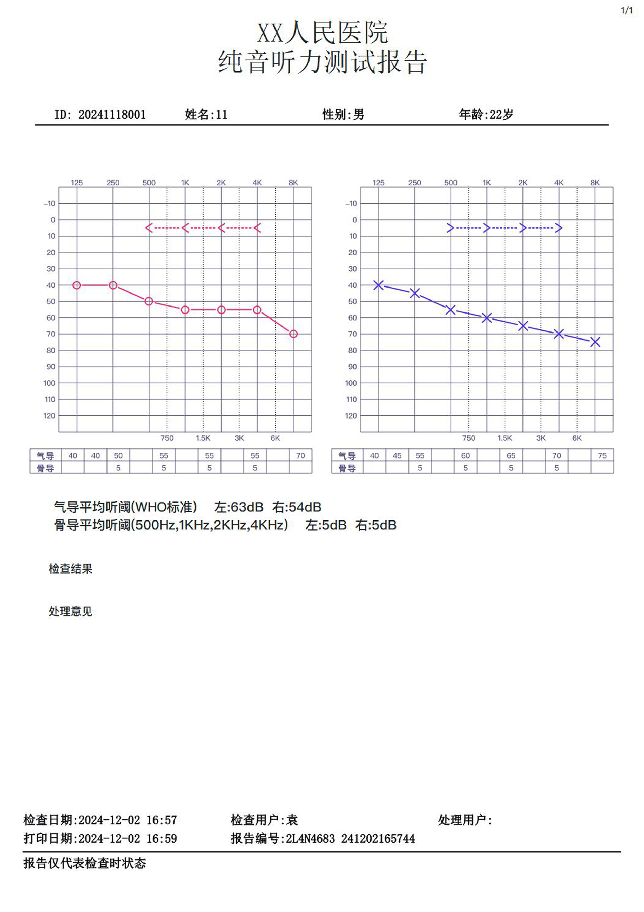 聆康纯音听力计LK-225升级版(图2)