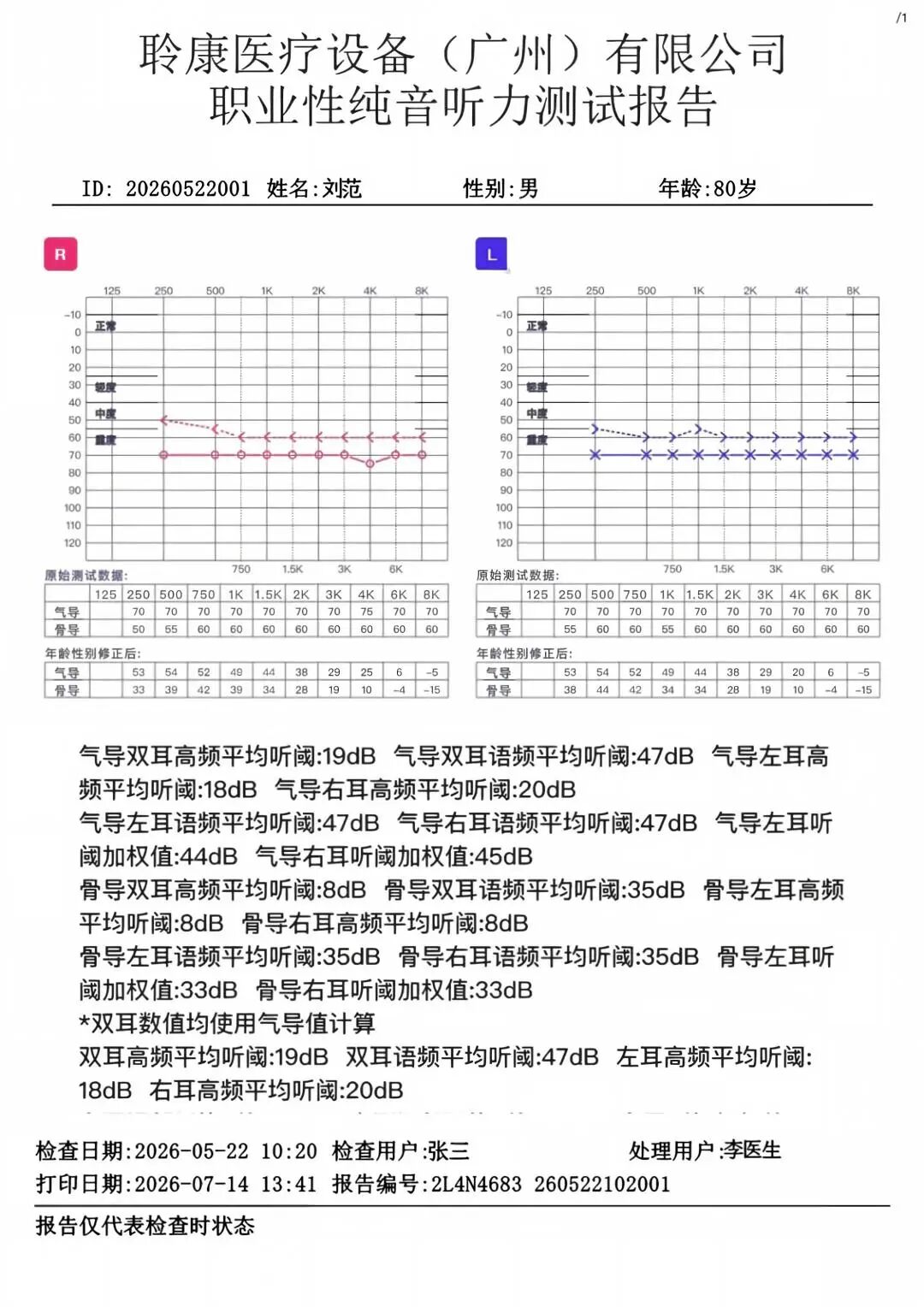 GB 23466‑2025新国标实施|噪声危害不容忽视,职业听力健康守护刻不容缓(图3) 3.png