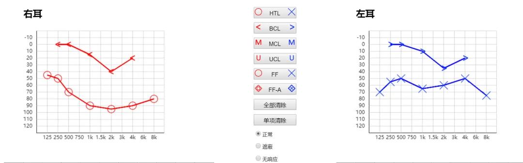 听管家｜聆康·听觉有道全生命周期数字化听力健康管理平台(图5)