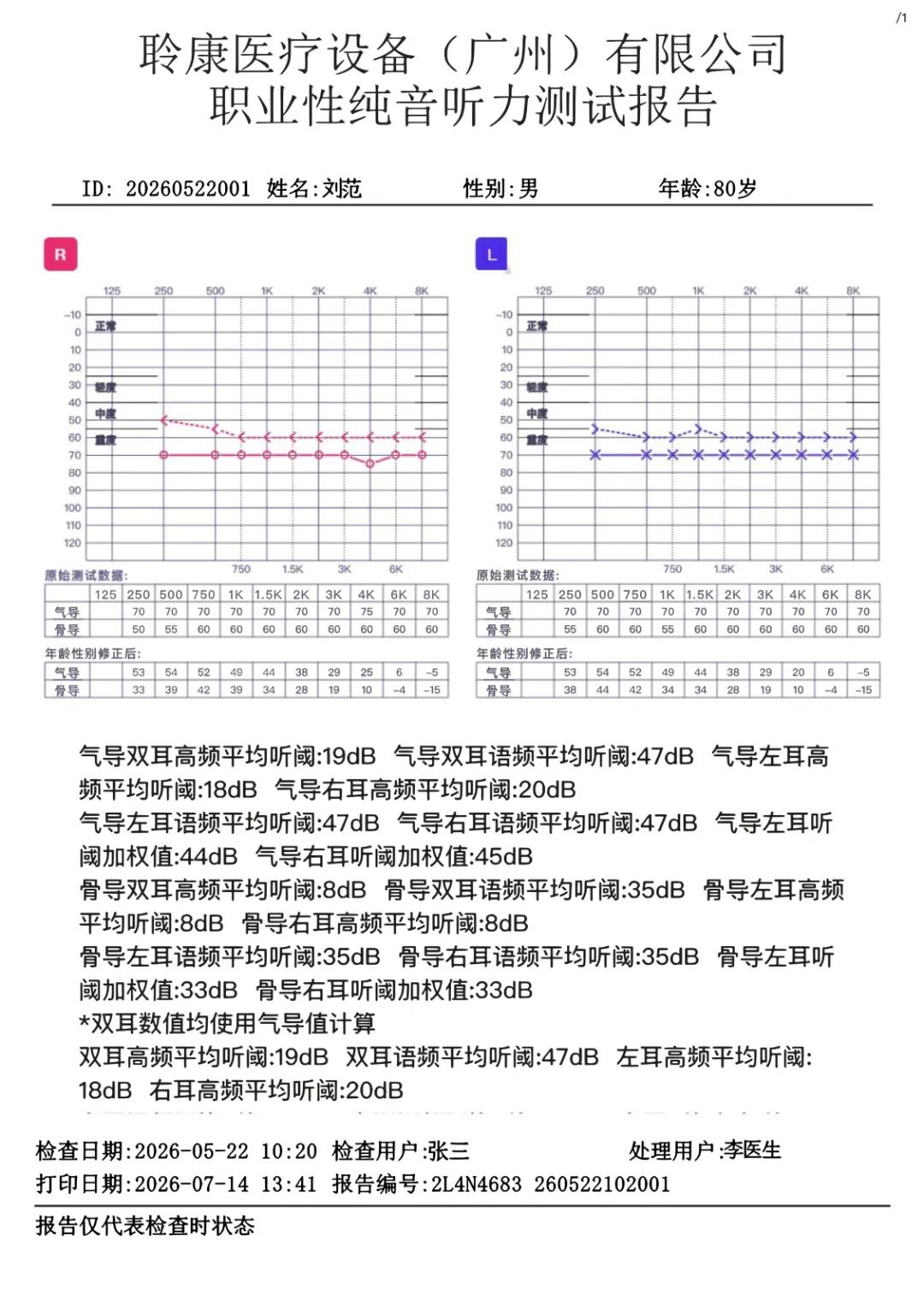 聆康纯音听力计|职业健康检查/职业病诊断核心优势(图3) 3.jpg
