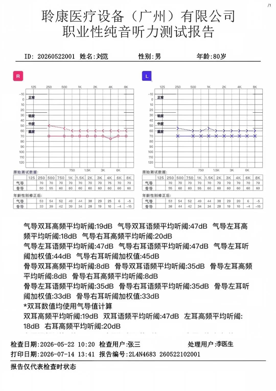 GB 23466‑2025新国标实施|职业听力健康守护刻不容缓(图3) 3.jpg